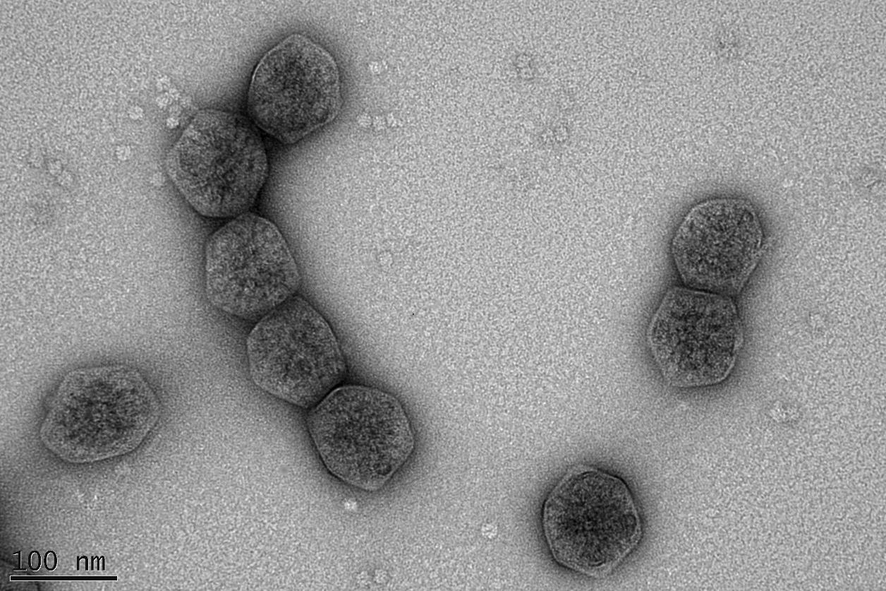 Carboxysome compartment with rubisco (image provide by Dr. Wil Hee, Dr. Ben Long from Price Lab, RSB)