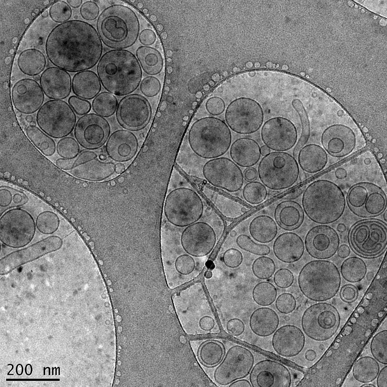 Liposomes viewed using the Hitachi H7100 TEM